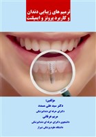 ترمیمهای زیبایی دندان و کاربرد پروتز و ایمپلنت
